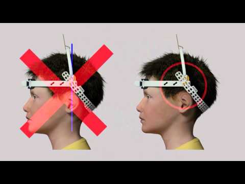HeadPod